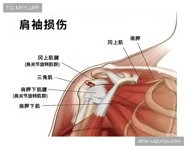 合法冲撞判罚依据：肩对肩与合理身体接触的判断标准